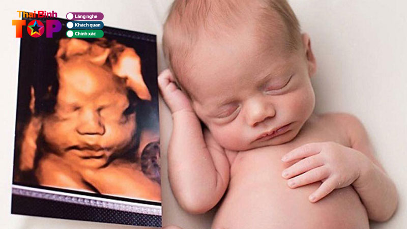 top-10-dia-chi-sieu-am-4d-tai-thai-binh-uy-tin-nhat-thaibinhtoplist