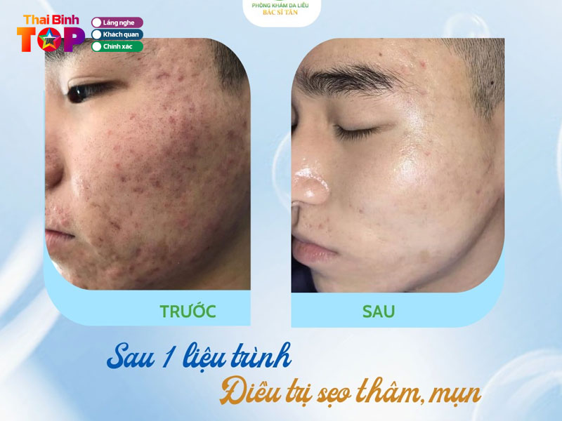Phong-kham-da-lieu-bac-si-tung-thaibinhtoplist