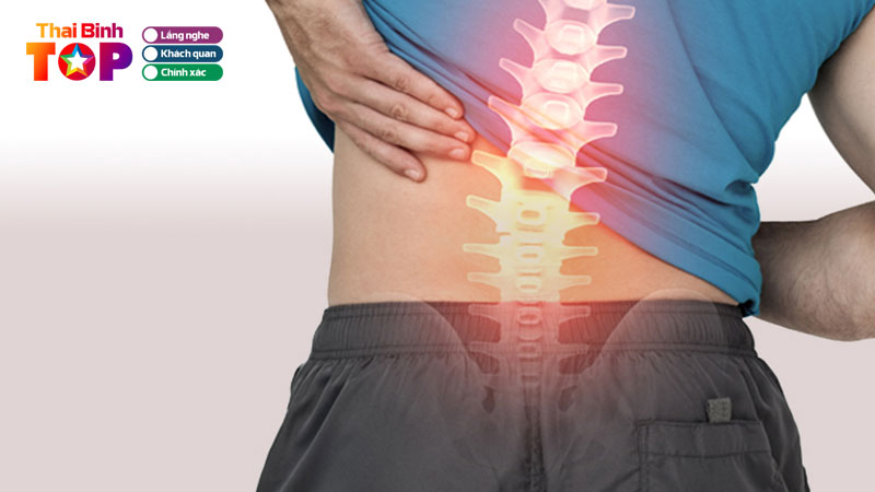 Top-6-benh-vien-chua-thoat-vi-dia-dem-thai-binh-dang-tin-cay-thaibinhtoplist