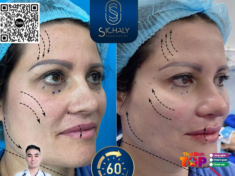 Tham-my-vien-spa-lam-dep-sichaly-thaibinhtoplist