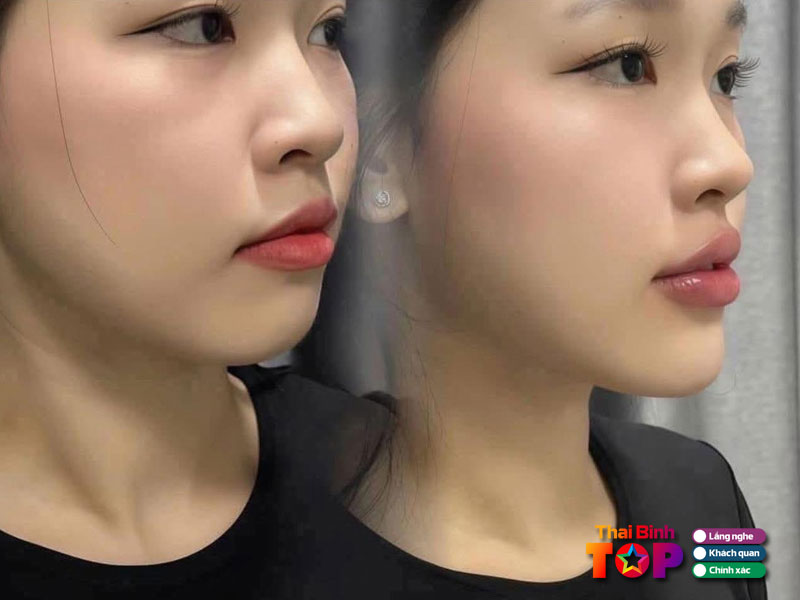 Kim-phuong-beauty-center-thaibinhtoplist