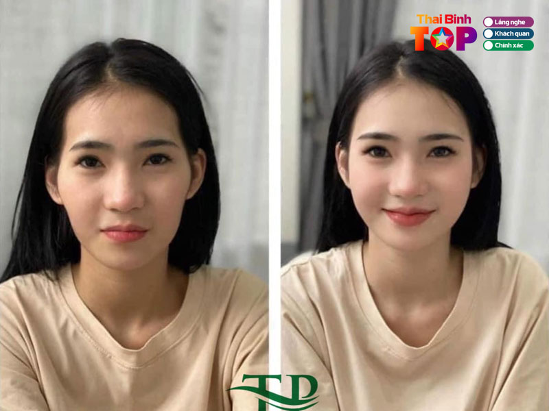 Tham-my-ellie-thaibinhtoplist