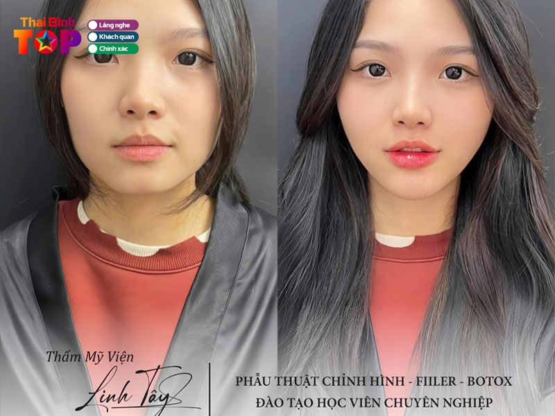 Tham-my-vien-linh-tay-thaibinhtoplist