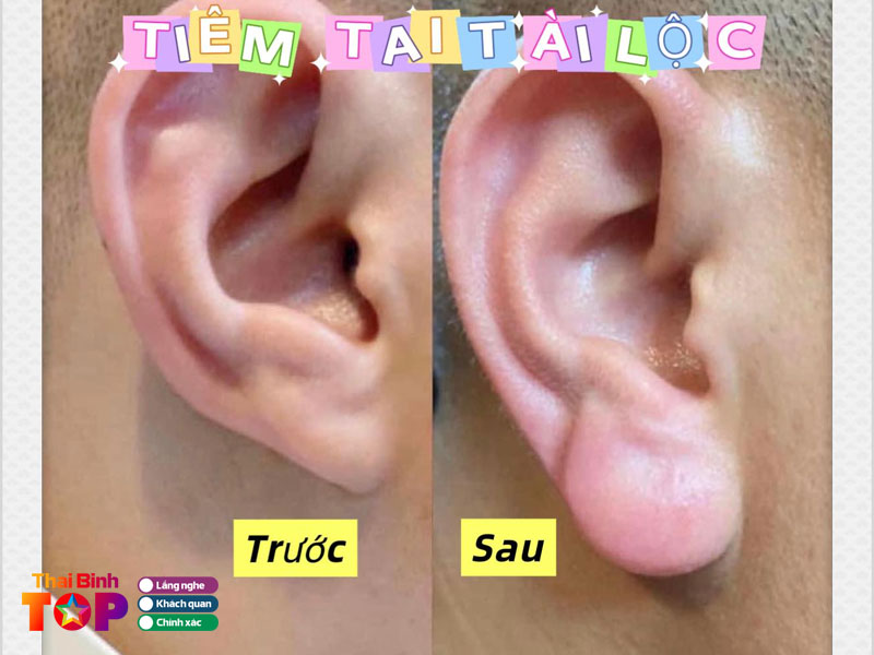 Tham-my-vien-van-xuan-sinh-thaibinhtoplist