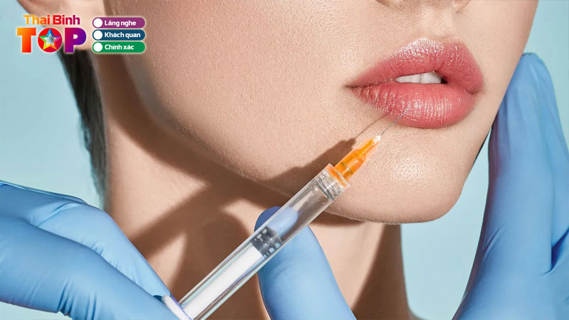 Top-10-dia-chi-tiem-filler-tai-thai-binh-uy-tin-chuan-y-khoa-thaibinhtoplist