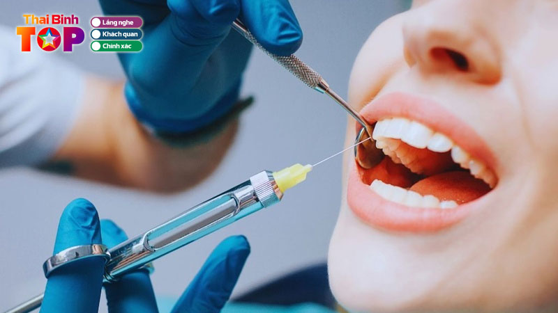 Cau-rang-su-la-gi-giai-phap-phuc-hinh-rang-mat-pho-bien-hien-nay-thaibinhtoplist