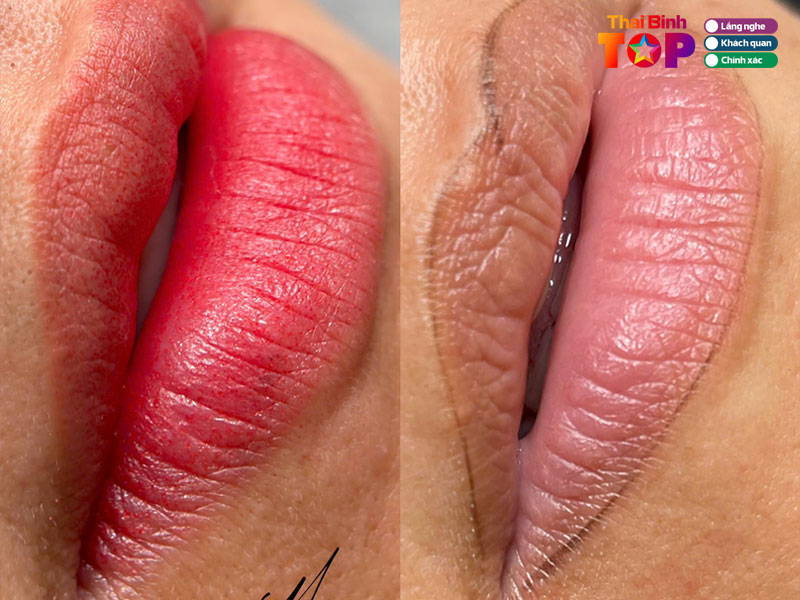 Mot-so-kinh-nghiem-khi-lua-chon-noi-khu-tham-moi-hieu-qua-va-an-toan-thaibinhtoplist