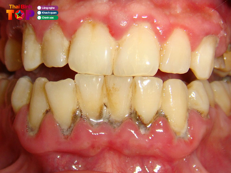 Nha-khoa-bao-khang-thaibinhtoplist