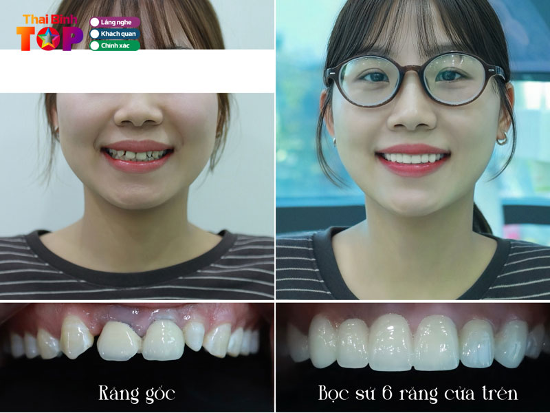 Nha-khoa-duc-hau-thaibinhtoplist