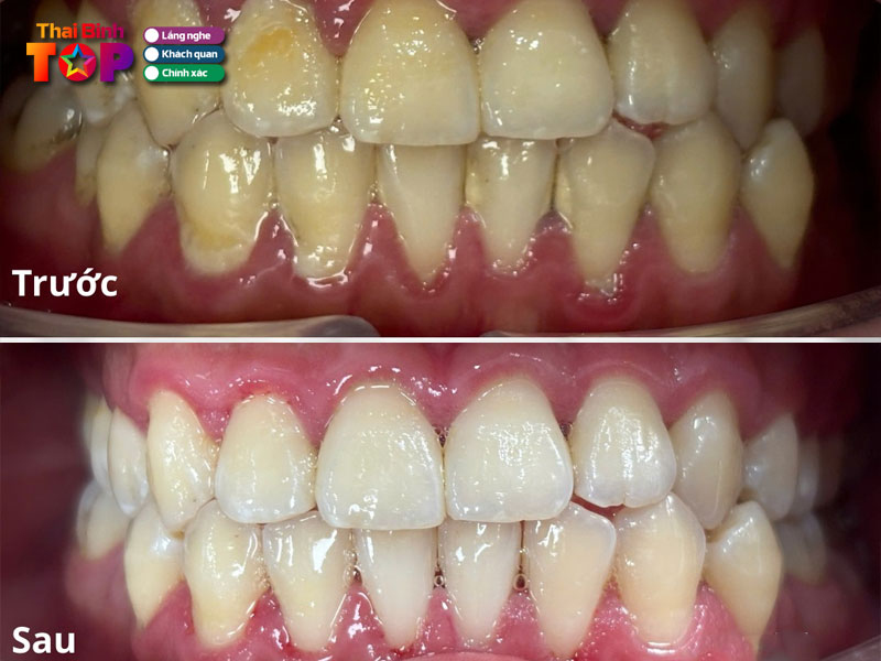 Nha-khoa-ngoc-tuan-thaibinhtoplist