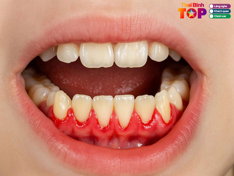 Nha-khoa-quoc-te-ruby-dental-thaibinhtoplist
