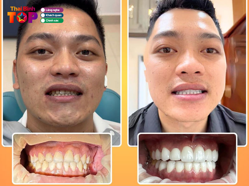 Nha-khoa-ruby-dental-thaibinhtoplist