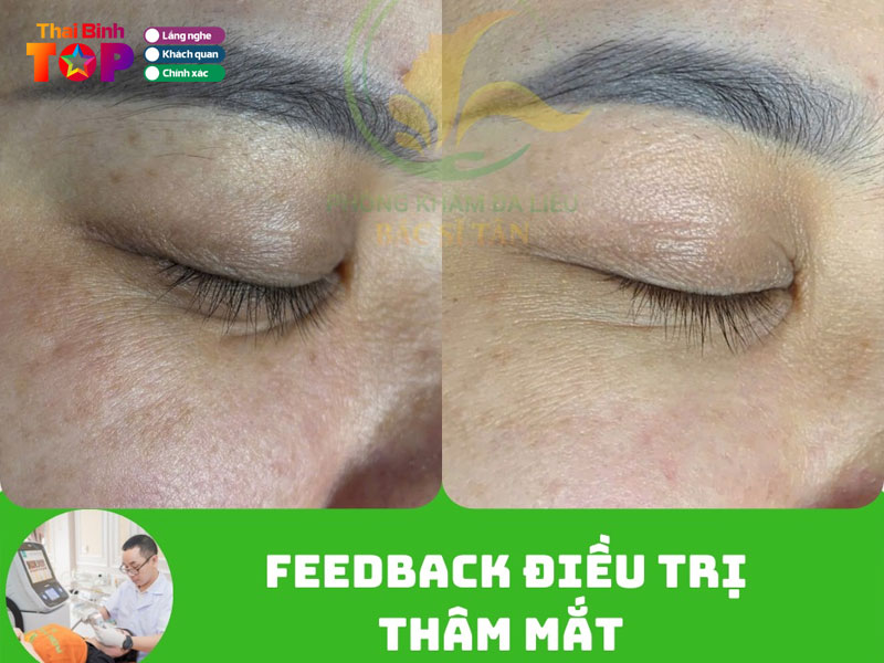 Phong-kham-da-lieu-bac-si-tan-thaibinhtoplist