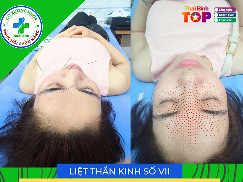 Phong-kham-hoai-anh-thaibinhtoplist