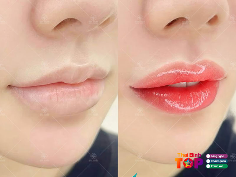 Tham-my-kim-ngan-thaibinhtoplist