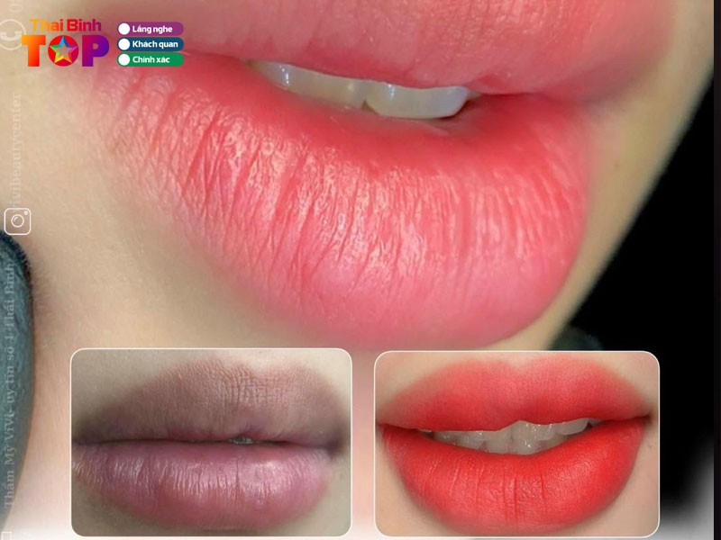 Tham-my-quoc-te-vivi-thaibinhtoplist