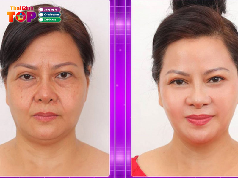 Tham-my-vien-quoc-te-mely-thaibinhtoplist