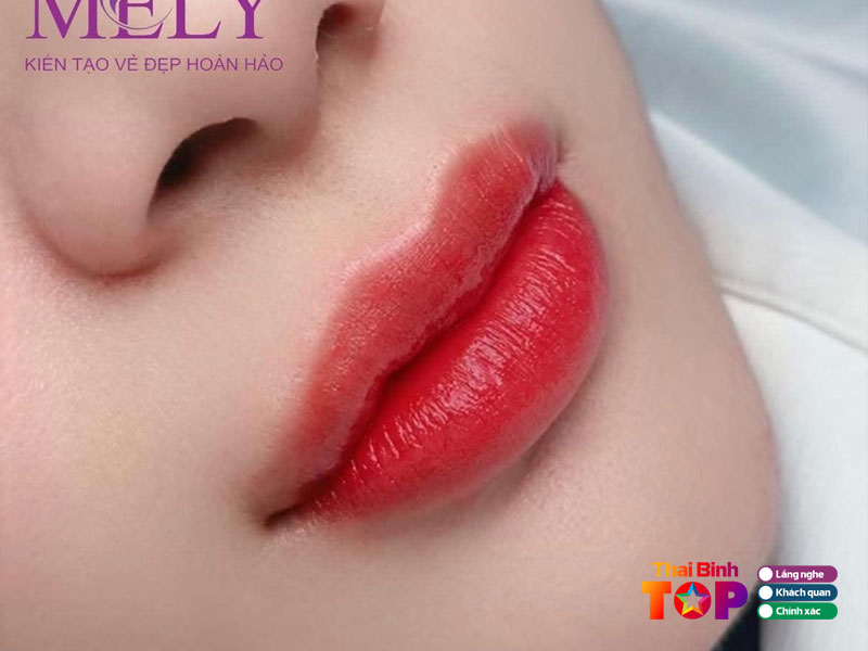 Tham-my-vien-quoc-te-mely-thaibinhtoplist