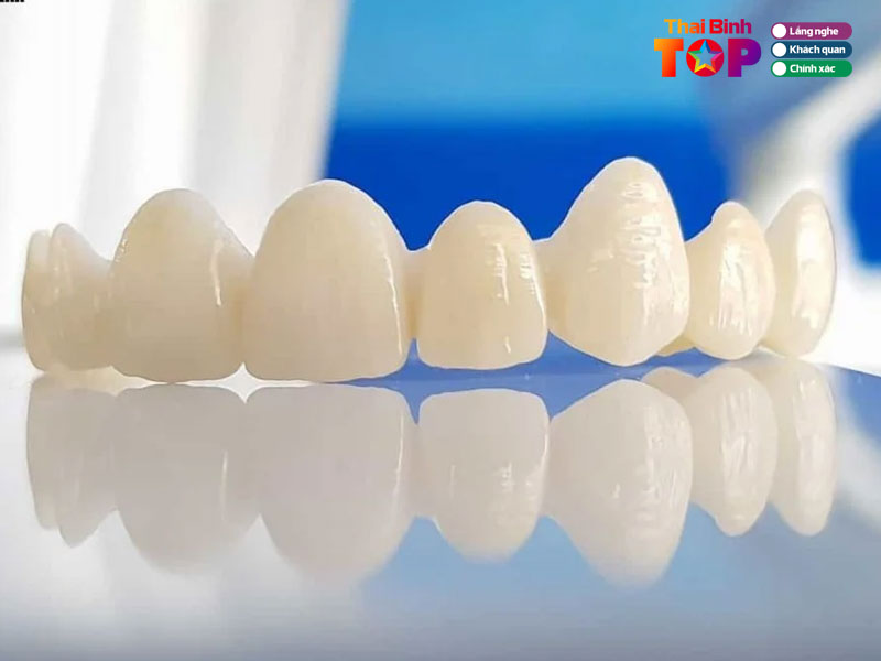 Tieu-chi-chon-dia-chi-boc-rang-su-uy-tin-thaibinhtoplist