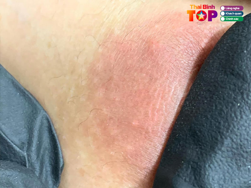 Tieu-chi-chon-lua-dia-chi-lam-hong-nhu-hoa-uy-tin-thaibinhtoplist