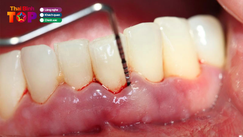 Top-10-dia-chi-dieu-tri-nha-chu-o-thai-binh-an-toan-bac-si-gioi-thaibinhtoplist