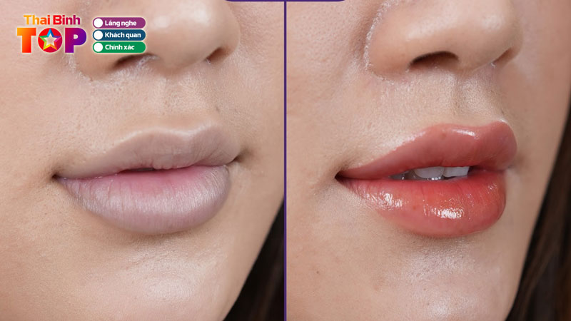 Top-10-spa-khu-tham-moi-o-thai-binh-chuyen-sau-va-an-toan-thaibinhtoplist