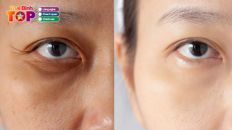 Top-10-spa-tri-tham-quang-mat-o-thai-binh-duoc-danh-gia-tot-thaibinhtoplist