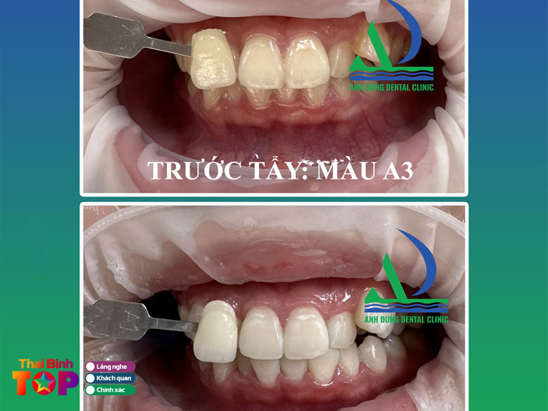 Trung-tam-nha-khoa-anh-dung-thaibinhtoplist