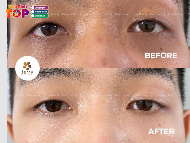 Vien-tham-my-jerry-thaibinhtoplist