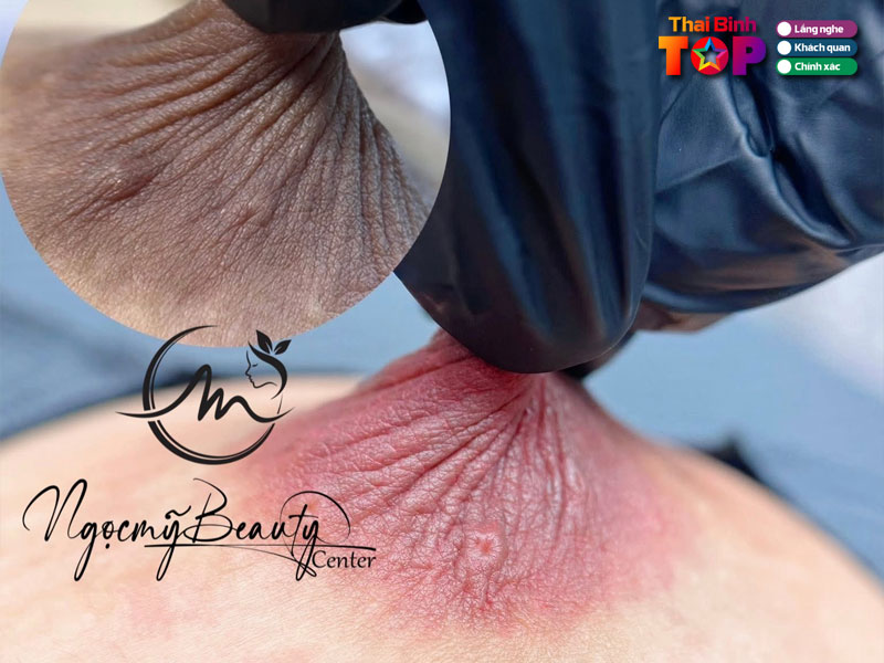 Vien-tham-my-quoc-te-ngoc-my-thaibinhtoplist