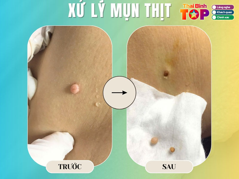 Kim-ngan-spa-thaibinhtoplist