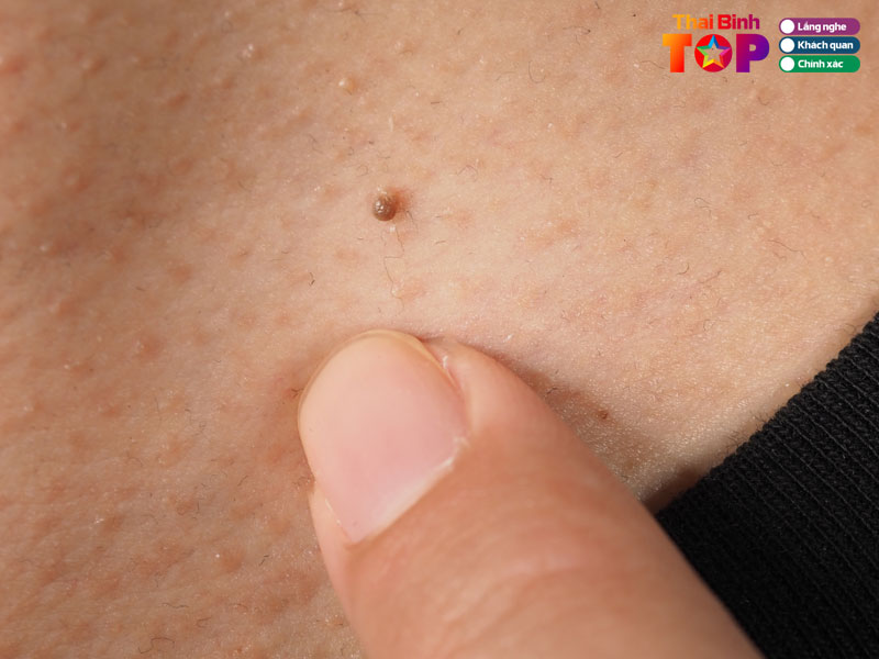 Kinh-nghiem-lua-chon-noi-tay-mun-thit-an-toan-va-hieu-qua-thaibinhtoplist