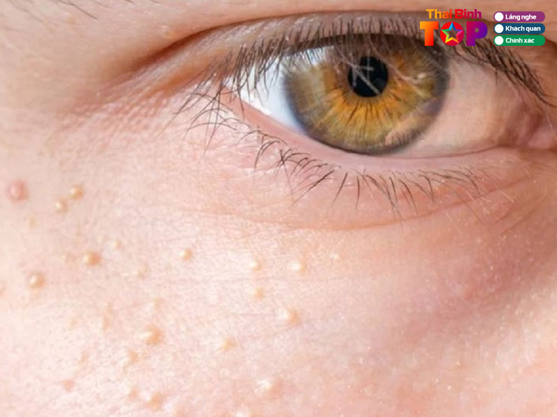 Phuong-mi-spa-thaibinhtoplist