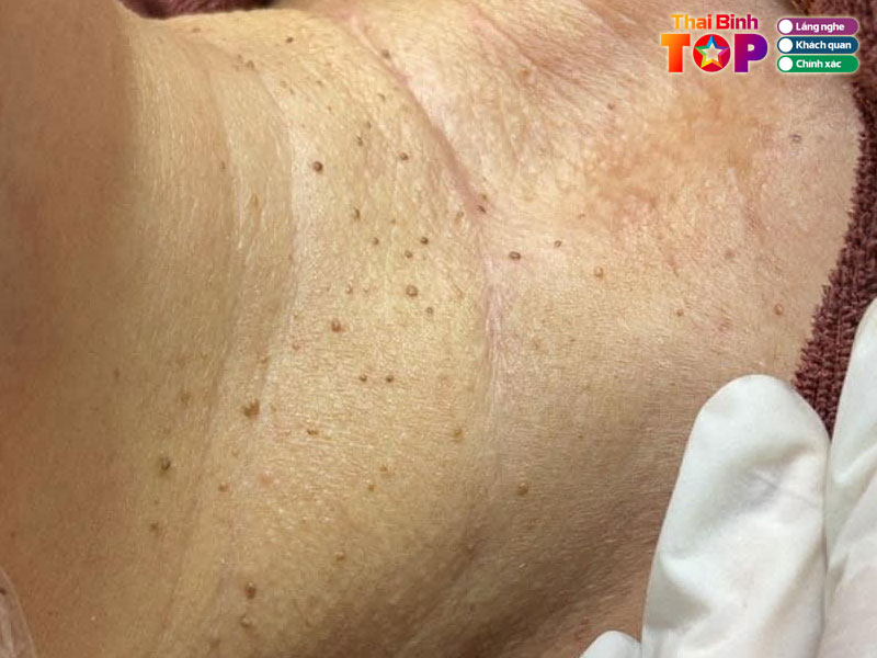 Tham-my-thien-huong-thaibinhtoplist