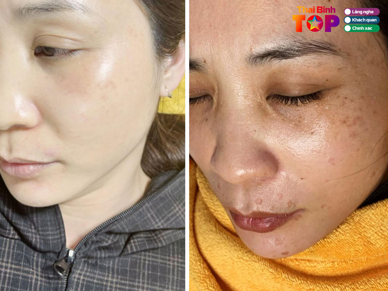 Vien-tham-my-at-thaibinhtoplist