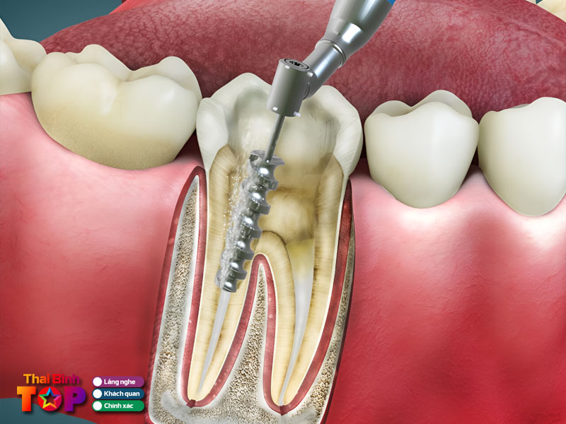 Nen-can-nhac-gi-khi-chon-dia-chi-chua-tuy-rang-thai-binh-thaibinhtoplist