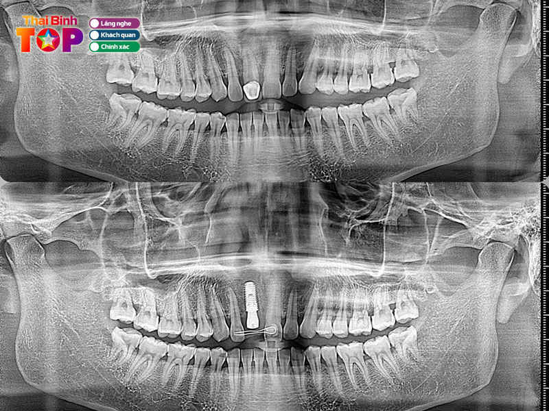Nha-khoa-duc-tuyen-thaibinhtoplist