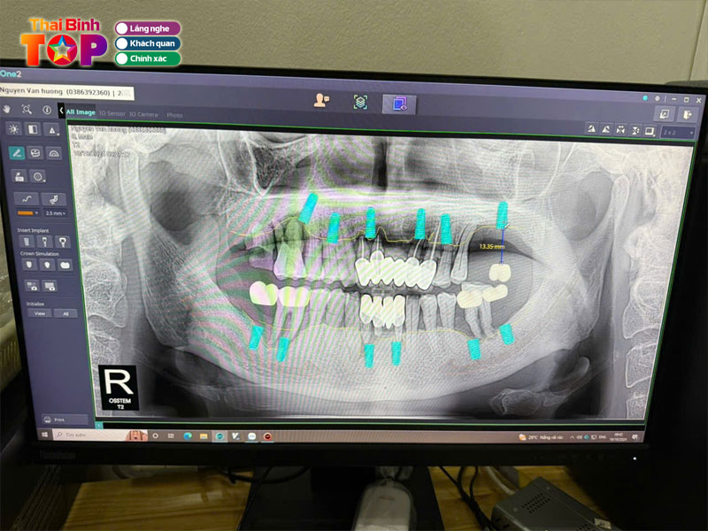 Nha-khoa-quoc-te-ruby-dental-thaibinhtoplist