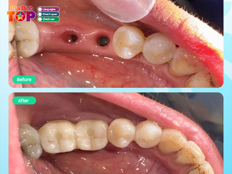 Nha-khoa-sing-thaibinhtoplist