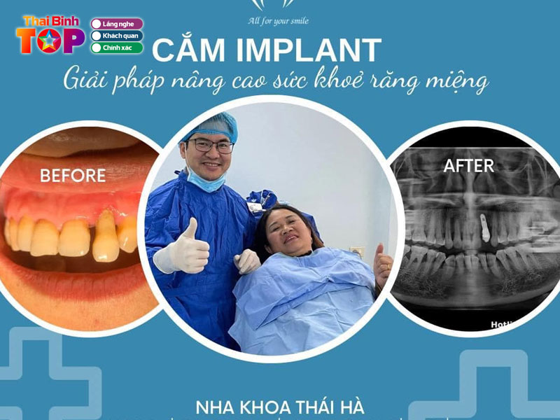 Nha-khoa-thai-ha-thaibinhtoplist