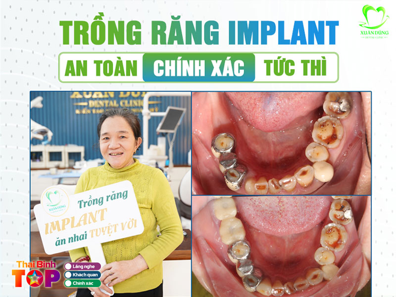 Nha-khoa-xuan-dung-thaibinhtoplist