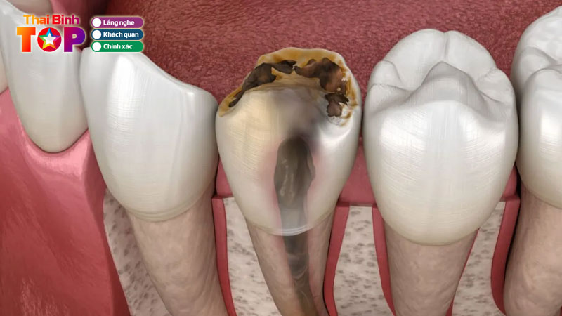 Top-5-dia-chi-chua-tuy-rang-thai-binh-dam-bao-an-toan-thaibinhtoplist