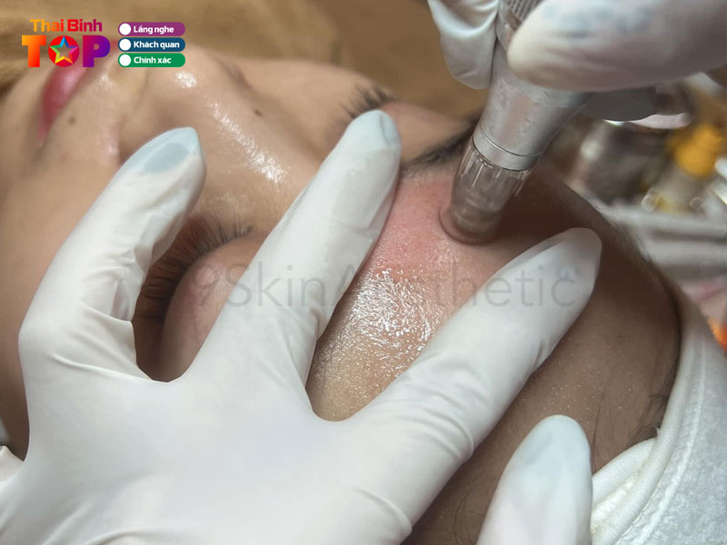 9skin-spa-aesthetic-thai-binh-thaibinhtoplist