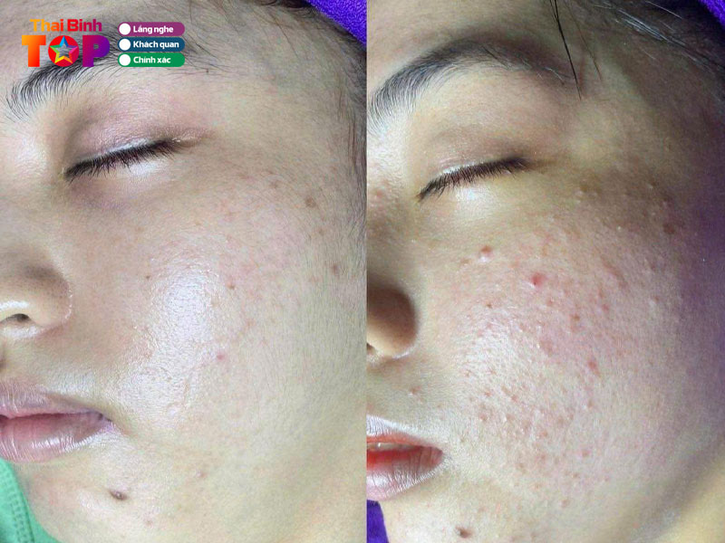 He-thong-tham-my-sbmedical-thaibinhtoplist