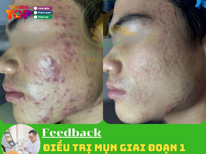 Phong-kham-da-lieu-bac-si-tan-thaibinhtoplist