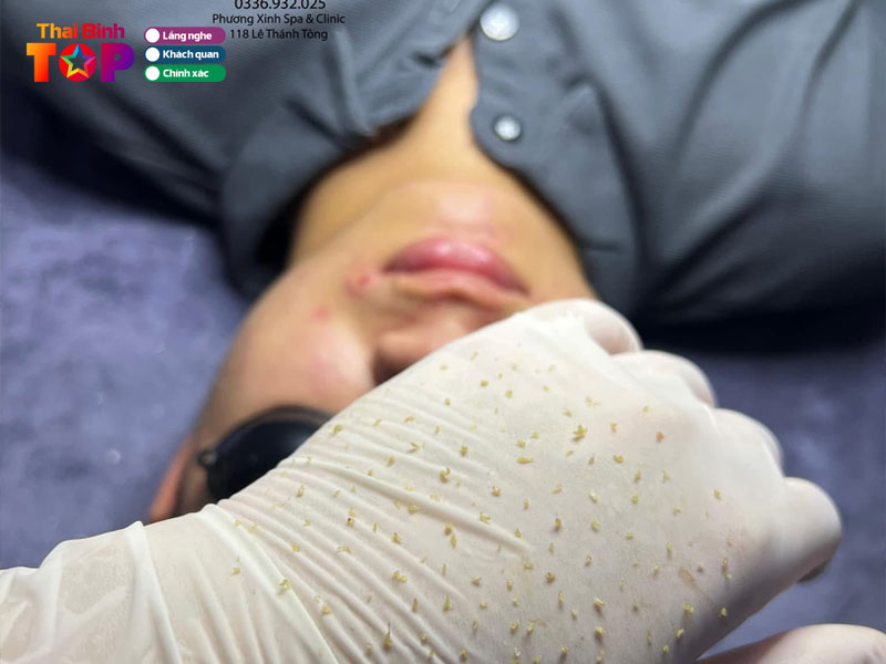 Spa-phuong-xinh-thaibinhtoplist