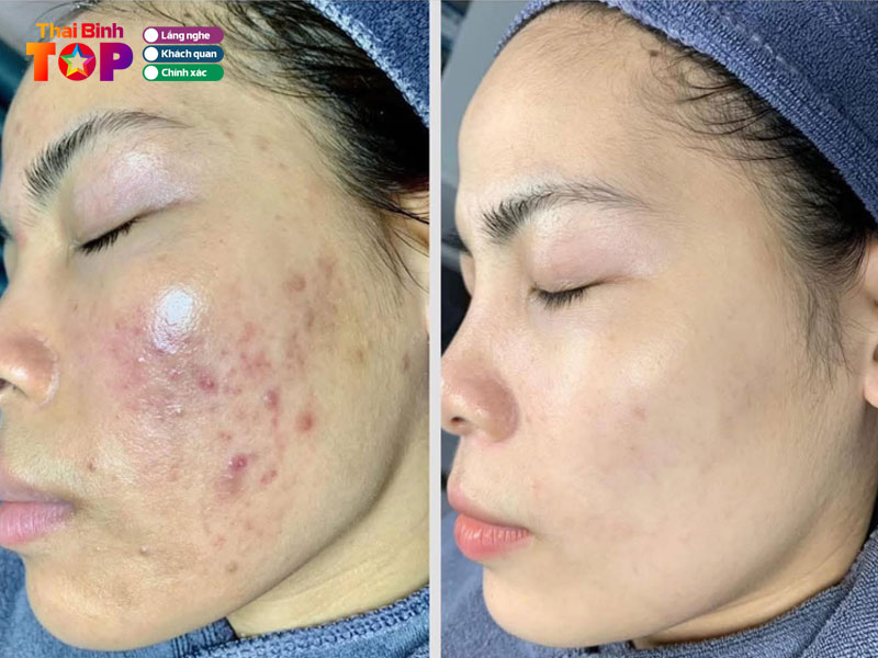 Spa-thuy-beauty-center-thaibinhtoplist