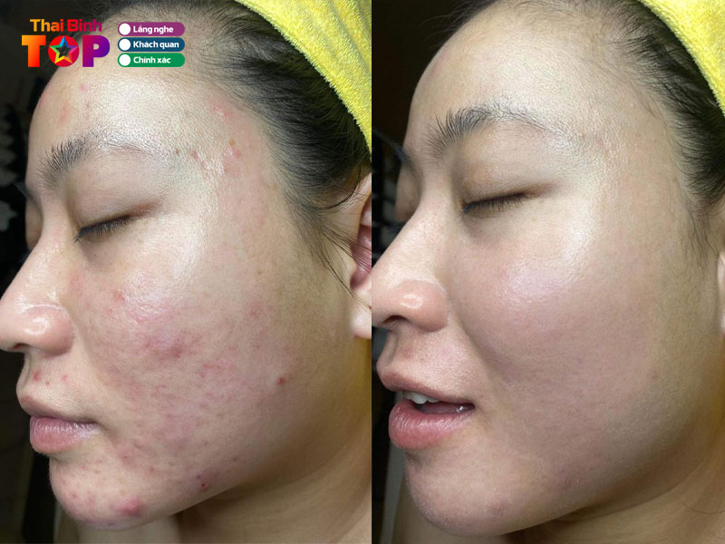 Tham-my-vien-ngoc-huong-thaibinhtoplist