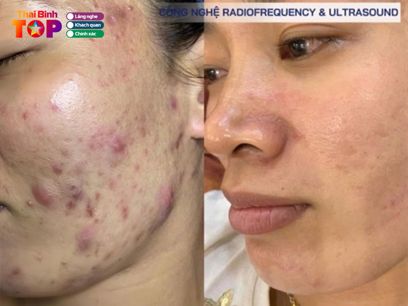 Tham-my-vien-quoc-te-mely-thaibinhtoplist