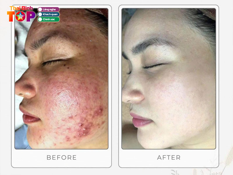 Aura-beauty-center-thaibinhtoplist